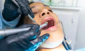 Znieczulenie u dentysty na NFZ: Kiedy jest bezpłatne i co musisz wiedzieć?